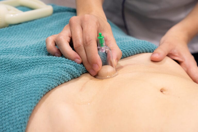 Cicatriz cesárea Zaragoza